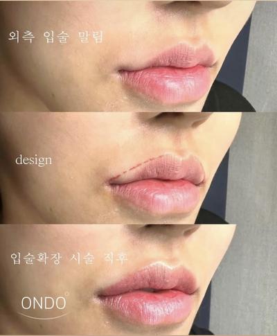 후기 사진 2
