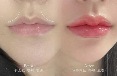 후기 사진 3