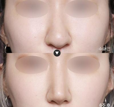 후기 사진 1