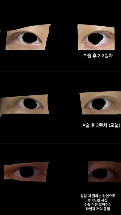 후기 사진 1