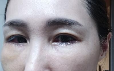 후기 사진 1