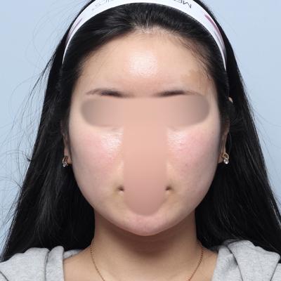 후기 사진 4