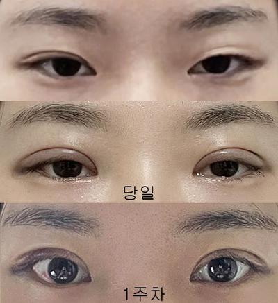 후기 사진 1