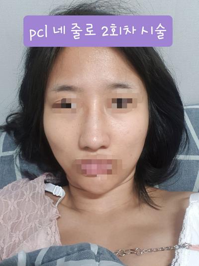 후기 사진 2