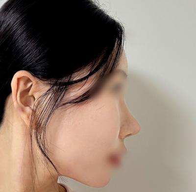 후기 사진 1