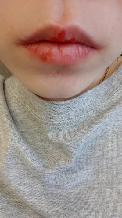 후기 사진 1