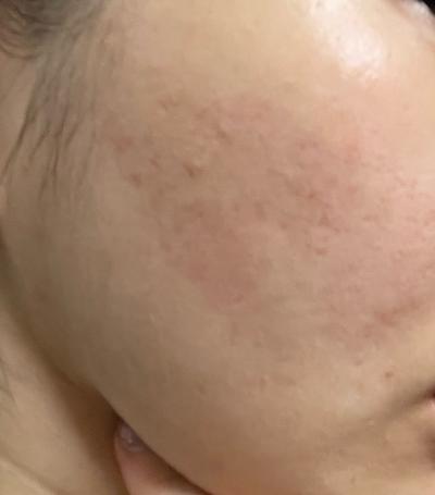 후기 사진 1