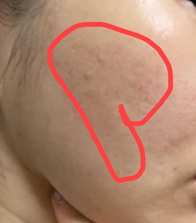 후기 사진 2