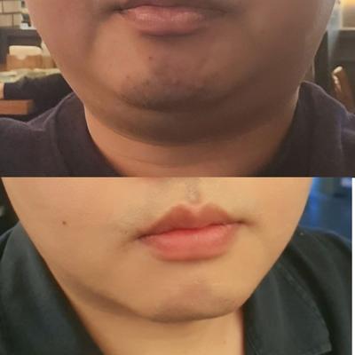 후기 사진 3