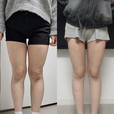 후기 사진 1