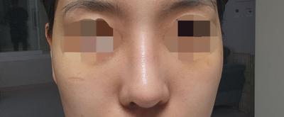 후기 사진 2