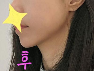 후기 사진 2