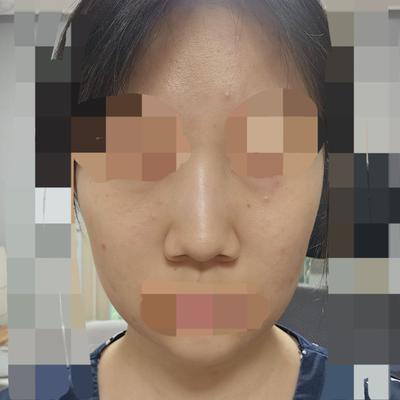 후기 사진 1