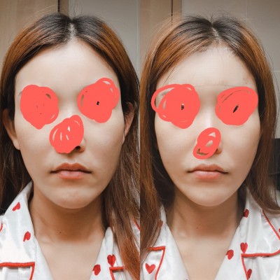 후기 사진 1