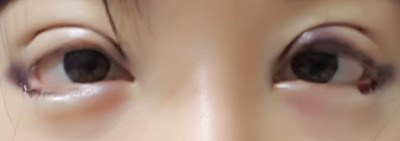 후기 사진 1