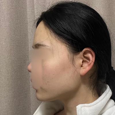 후기 사진 5