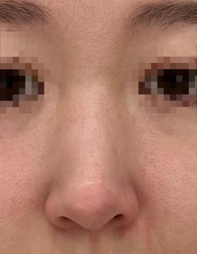 후기 사진 2