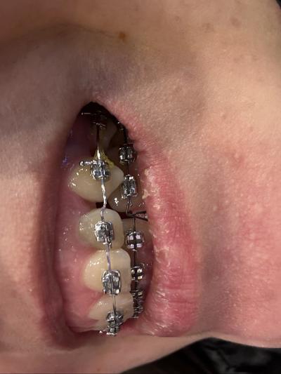 후기 사진 1