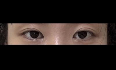 후기 사진 1