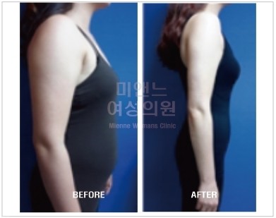 후기 사진 1