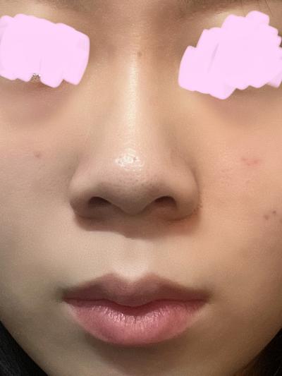 후기 사진 3