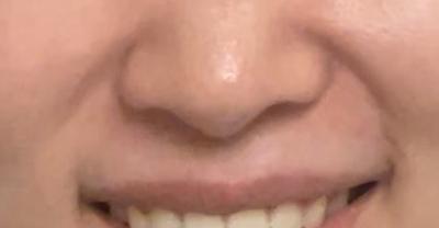 후기 사진 2