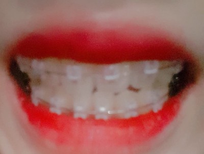 후기 사진 1