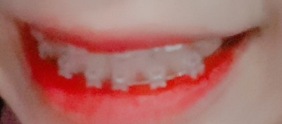 후기 사진 2