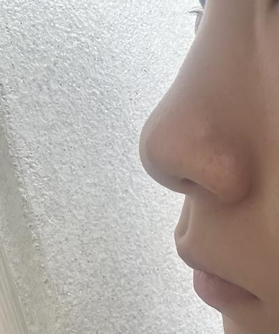 후기 사진 2