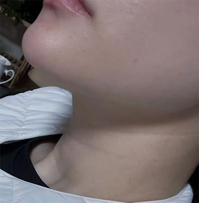 후기 사진 5