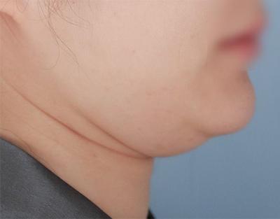 후기 사진 3
