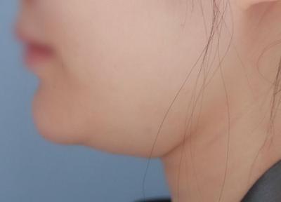 후기 사진 1