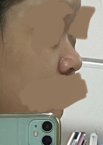 후기 사진 2