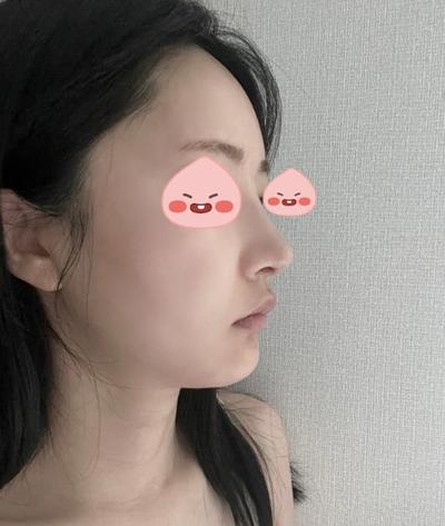후기 사진 5