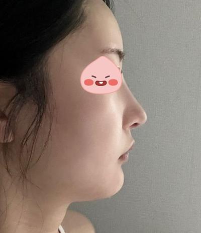 후기 사진 4