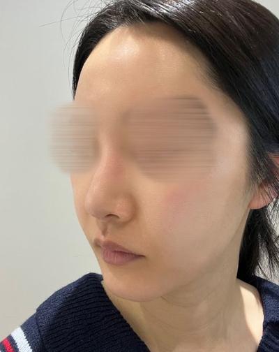 후기 사진 2