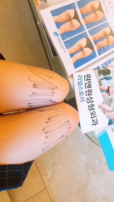 후기 사진 1