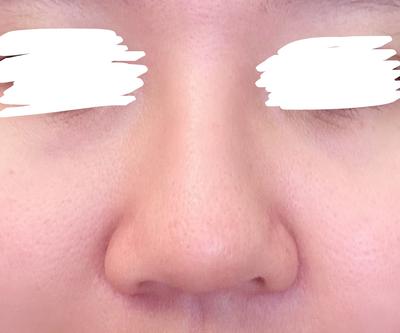 후기 사진 1