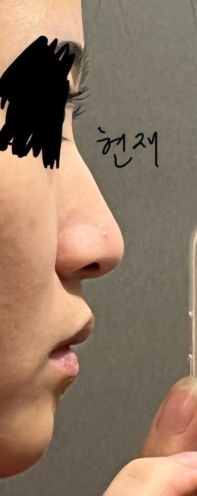 후기 사진 1