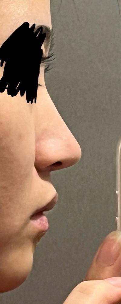 후기 사진 2