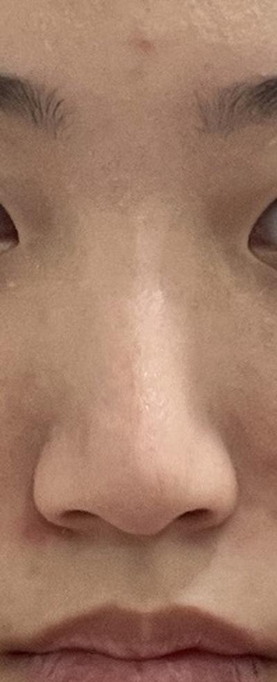후기 사진 4
