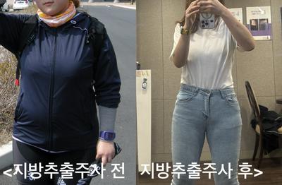 후기 사진 1