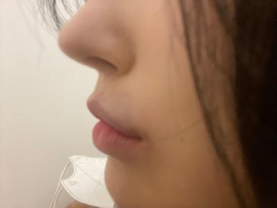 후기 사진 1