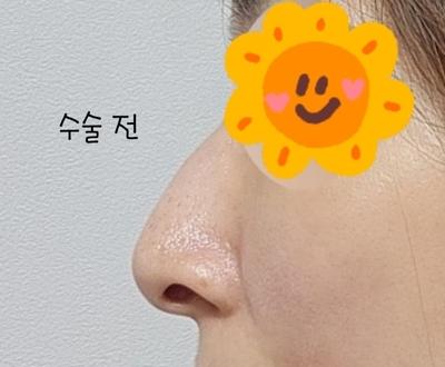 후기 사진 1