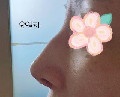 후기 사진 4