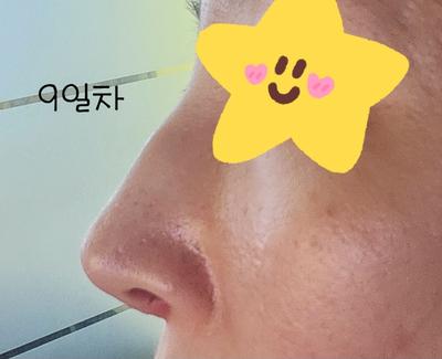 후기 사진 3