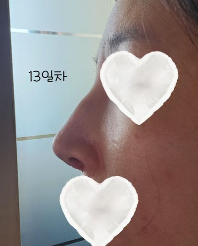 후기 사진 2