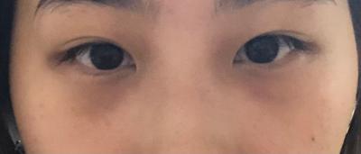 후기 사진 1
