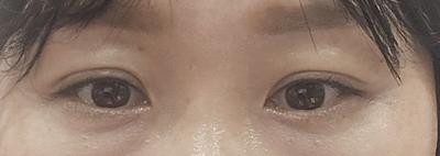 후기 사진 1