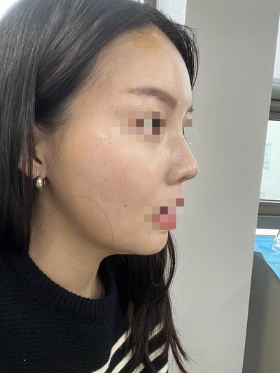 후기 사진 2